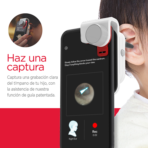Dispositivo digital para revisión de oídos SmartCheck® de Children's  TYLENOL®